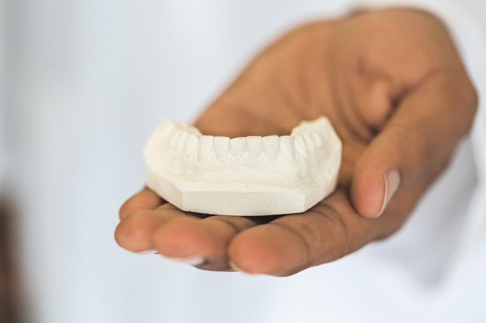 Free Image of Close up of a dental cast in a dentist s hand 