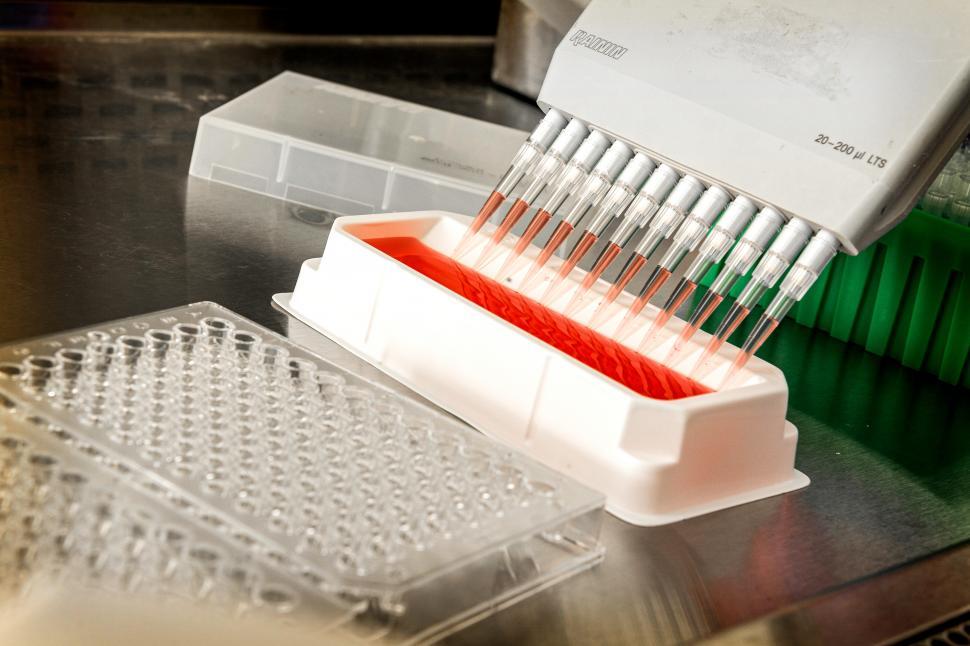 Free Stock Photo of Blood tests performed in the lab Download Free