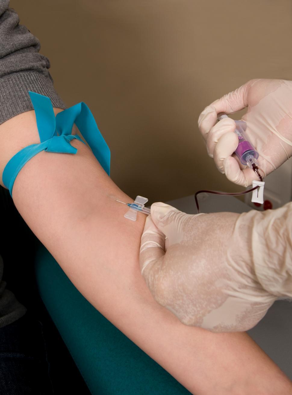 Free Image of Extracting blood from a patient 