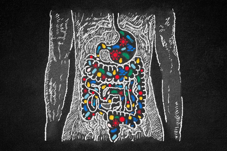 Free Image of Probiotics and Gut Microbiome - Gastrointestinal Diseases and Le 