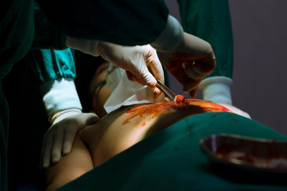 Free Image of Doctors operate in case of critical illness 