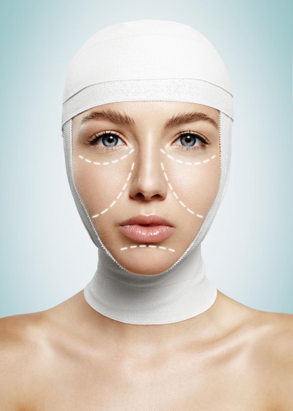 Free Stock Photo of Woman with bandaged head and cosmetic surgery lines ...