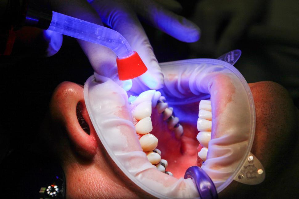 Free Image of A person with a mouth open and a blue light 