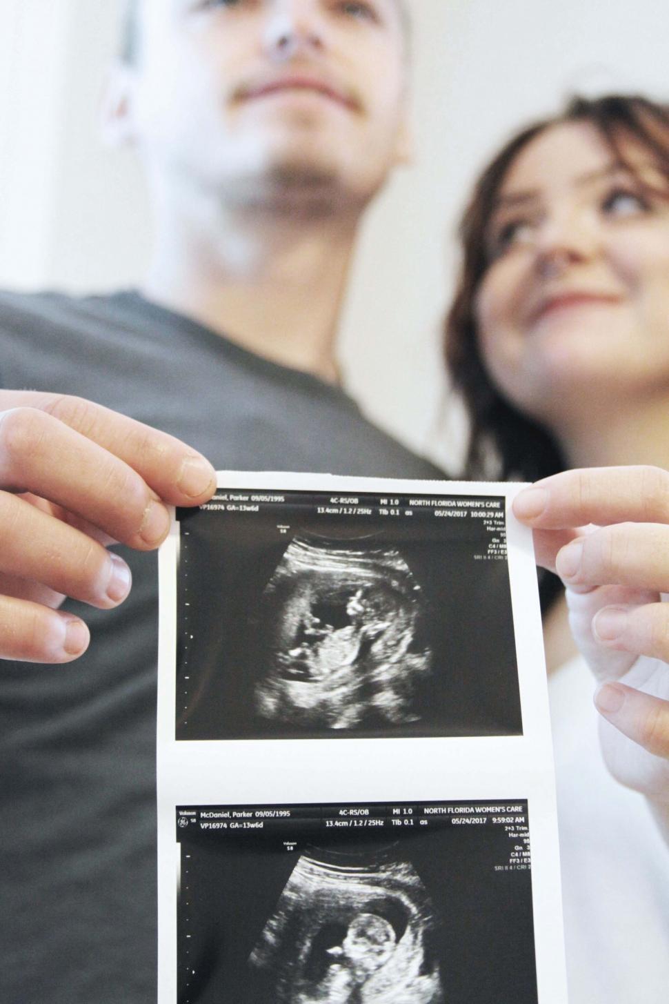 Free Image of Couple with ultrasound photo expressing joy 
