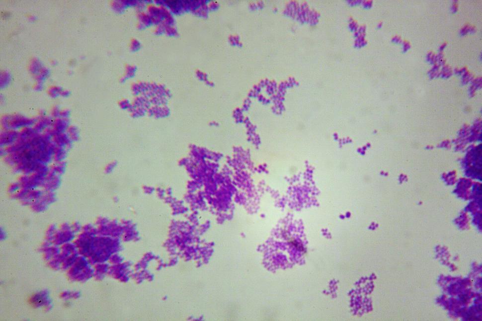 Picture showing Staphylococcus aureus under the microscope