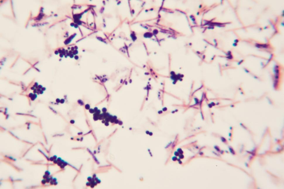 cocci bacteria under microscope