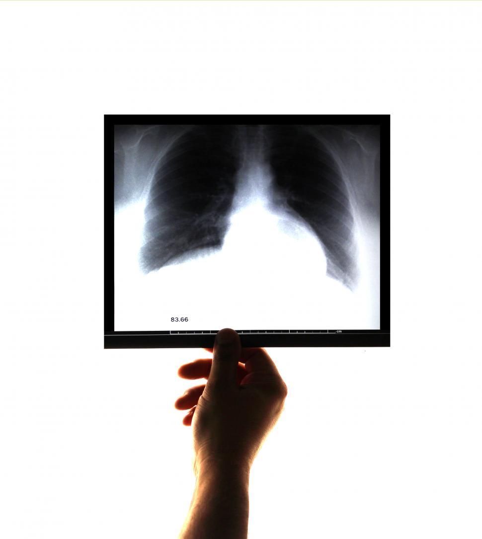 Free Image of Doctor examining and holding an x-ray image on his hand 