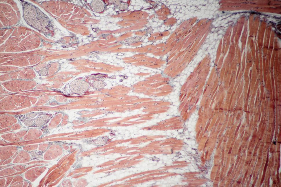 Free Image of Muscle Meat - Biopsy 