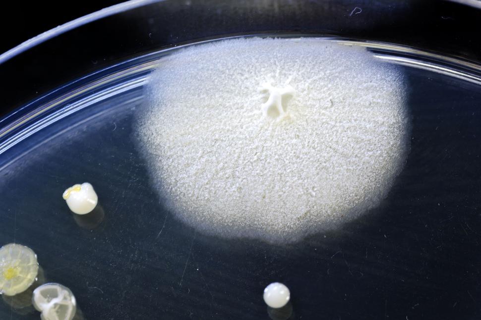 Free Image of Petri Dish Bacteria 