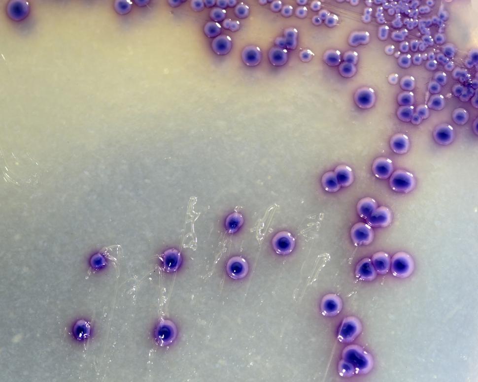Free Image of Macro of E. coli colonies 