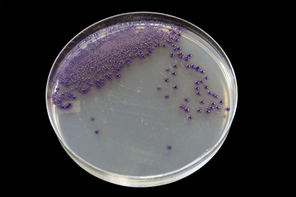 Free Image of Agar plate showing E. coli 