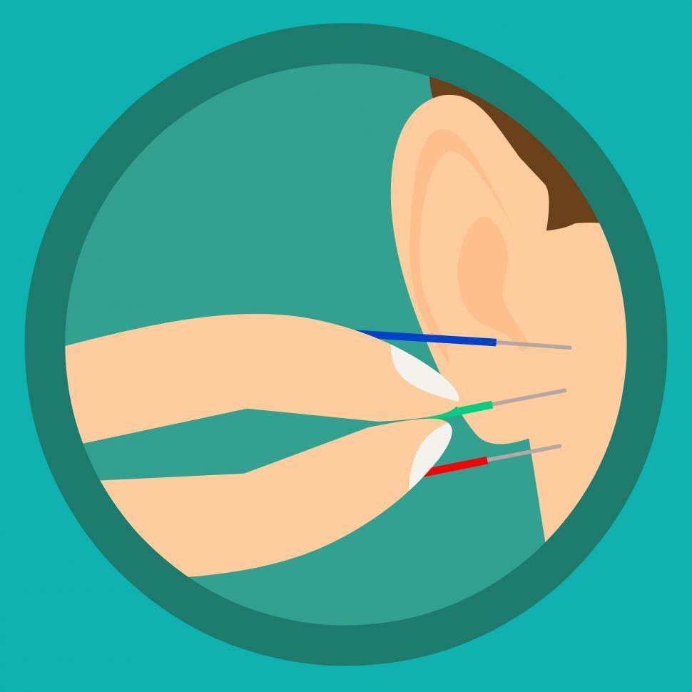 Free Image of acupuncture ear needles  