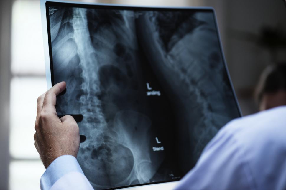 Free Image of Close up of an x-ray image being examined by a doctor 