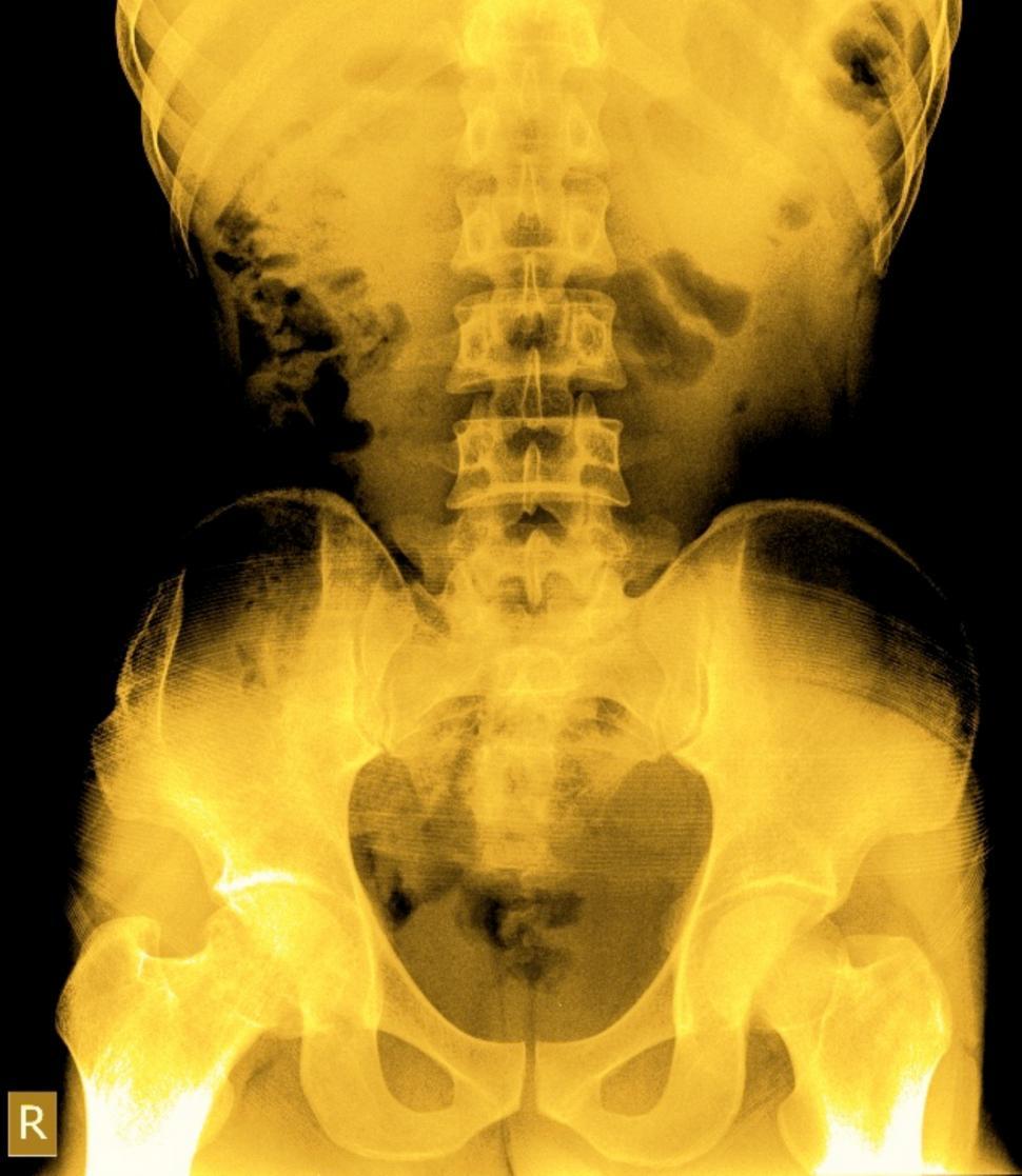 Free Image of A Filmed x ray from medical check up  