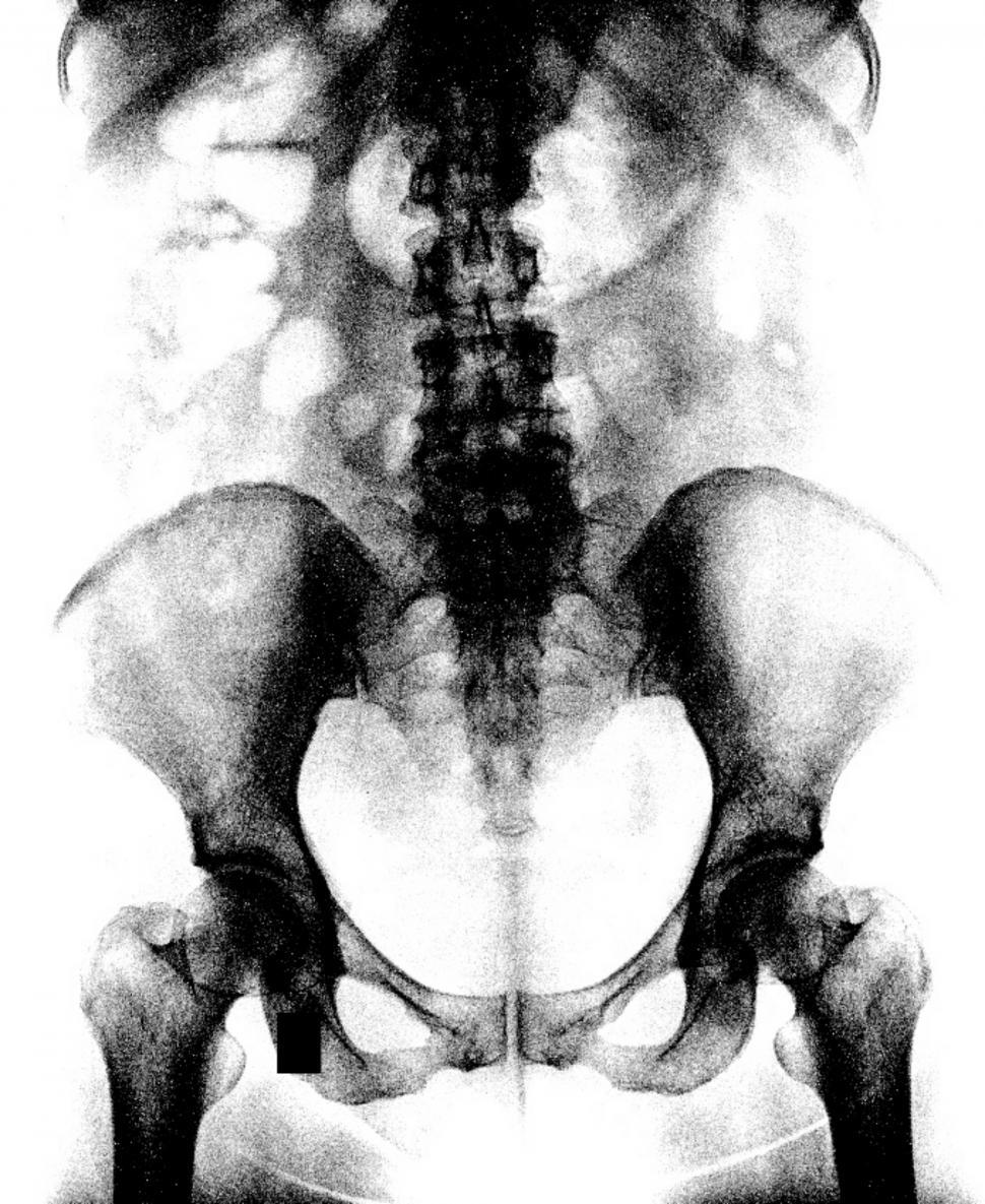 Free Image of A Human x ray radiology from medical check up  