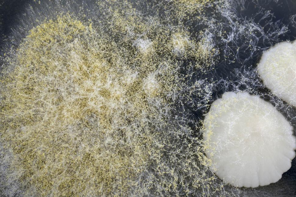 Free Image of Yeast and mold  
