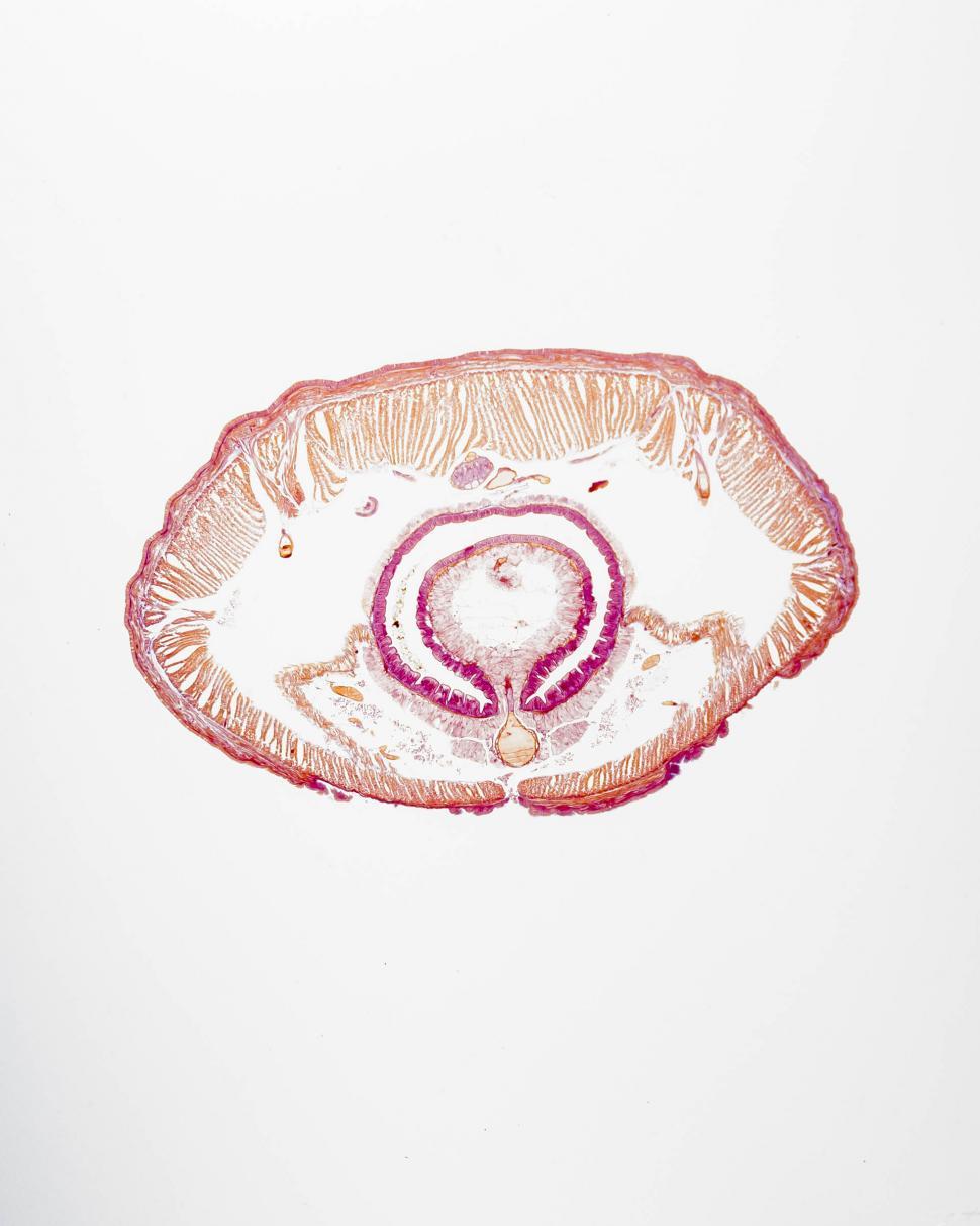 Free Image of Earthworm posterior to clitellum 