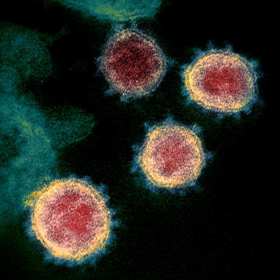 Free Image of Electron microscope image of Covid-19 Virus 