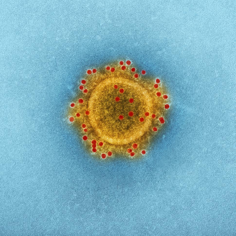 Free Image of Magnified Coronavirus Virion 