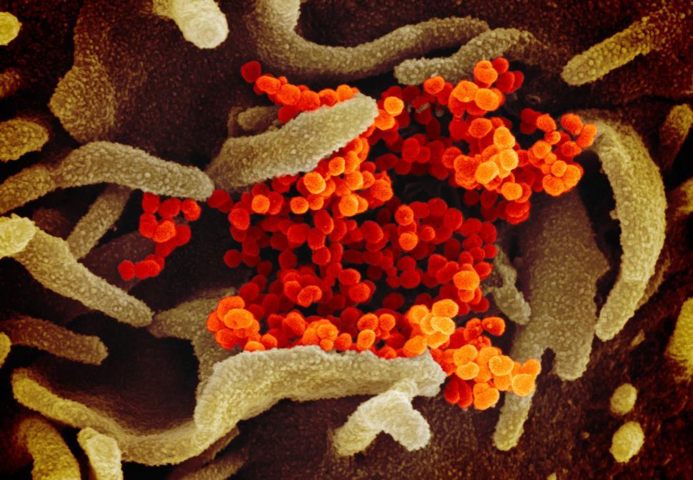 Free Image of Virus emerging from the surface of cells  