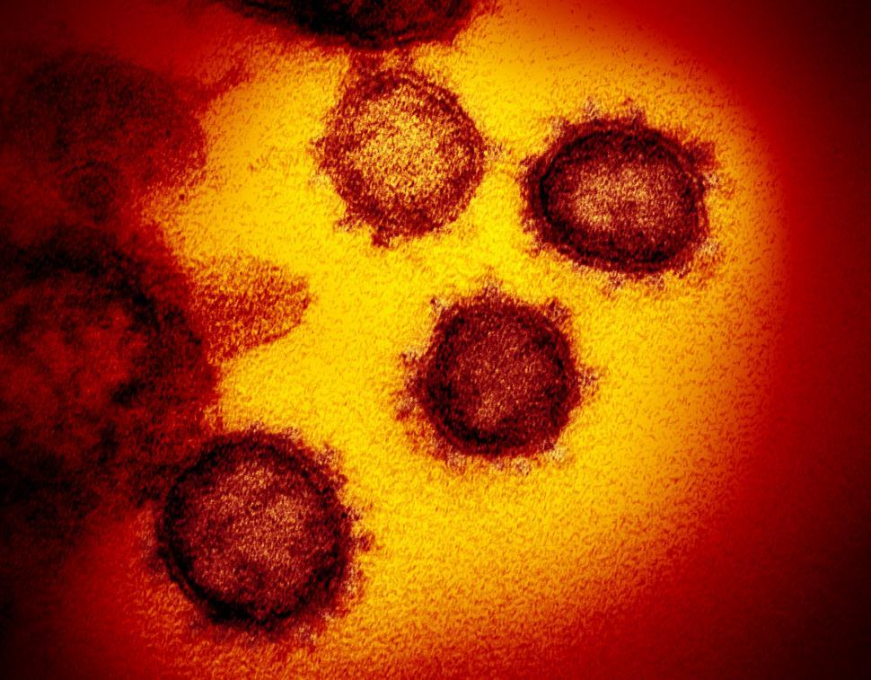 Free Image of The virus that causes COVID-19 