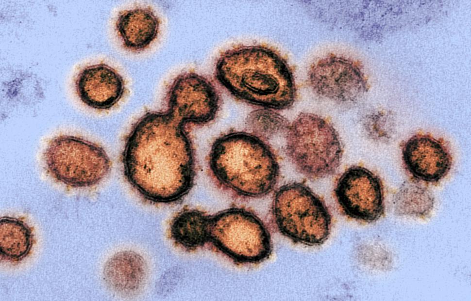 Free Image of Novel Coronavirus SARS-CoV-2 