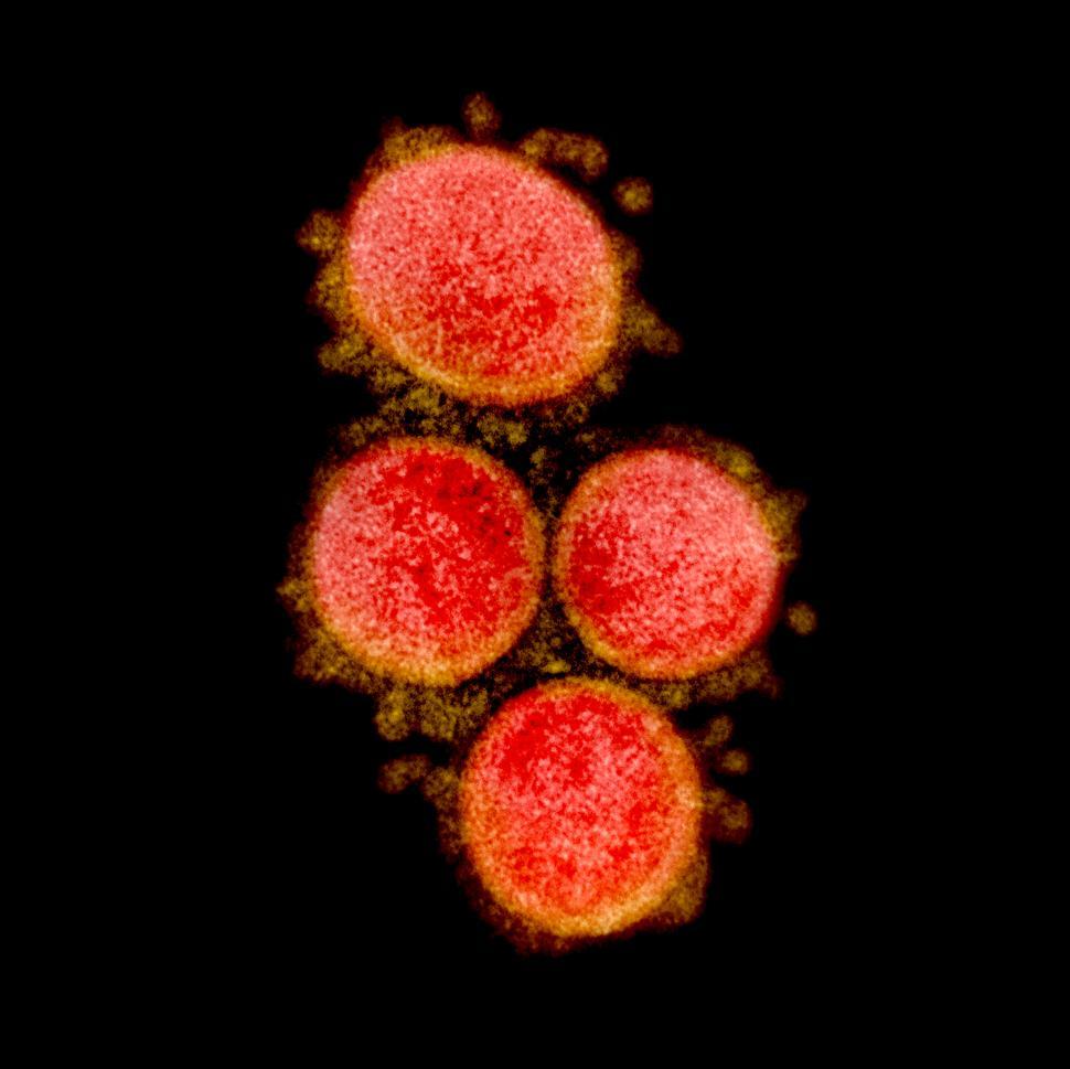 Free Image of SARS-CoV-2 virus particles 