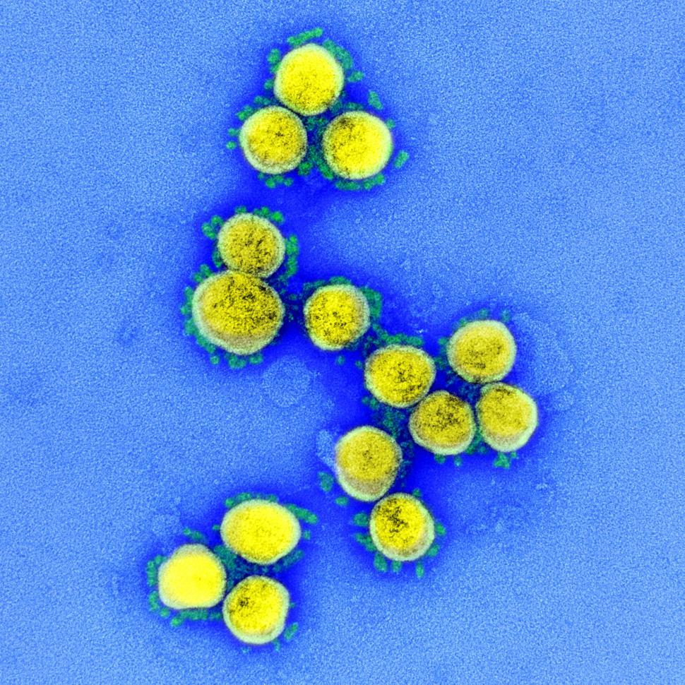 Free Image of Coronavirus imaging  
