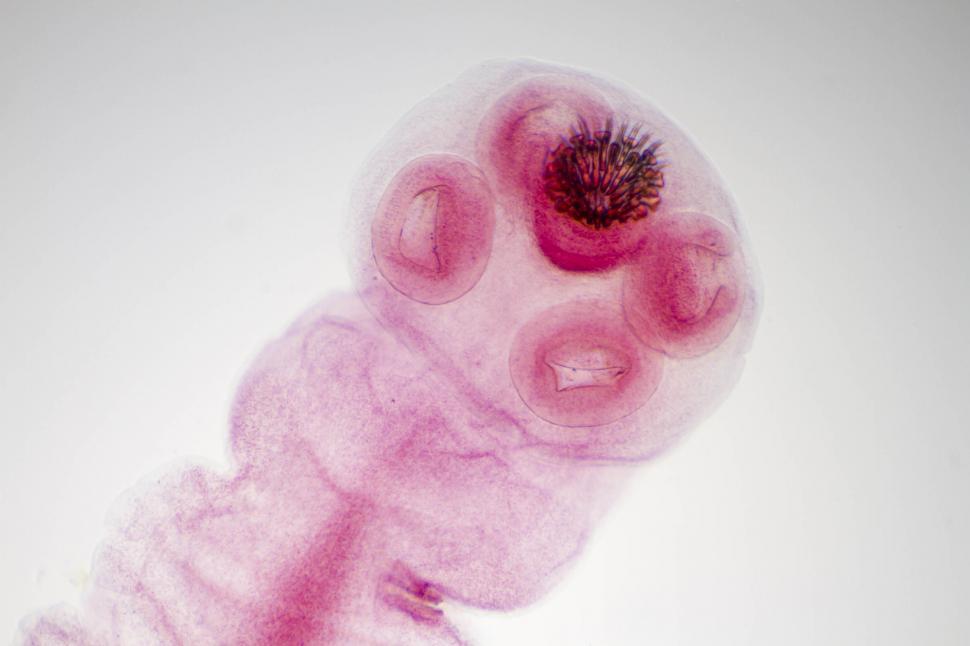 Free Image of Young tapeworm 
