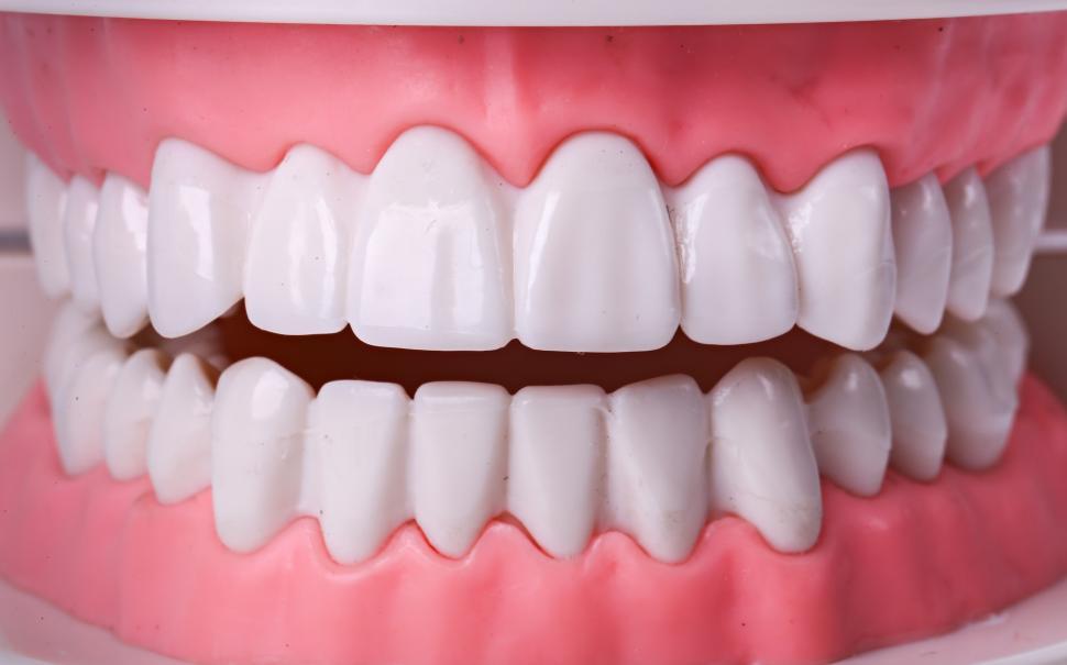 Free Image of Set of White teeth - Dental Model 
