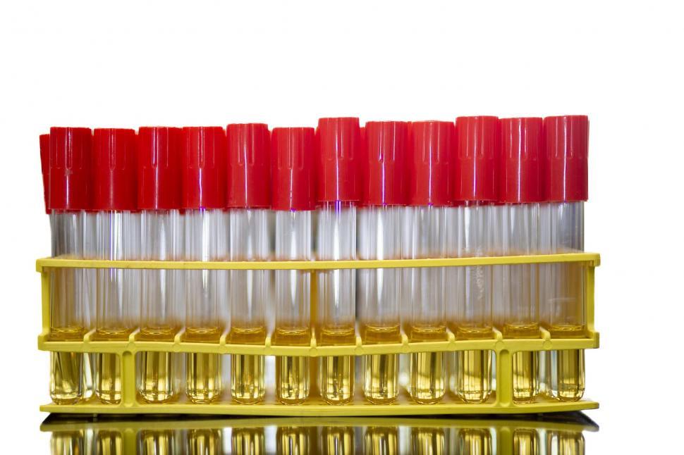 Free Image of Rack of test tubes containing media 