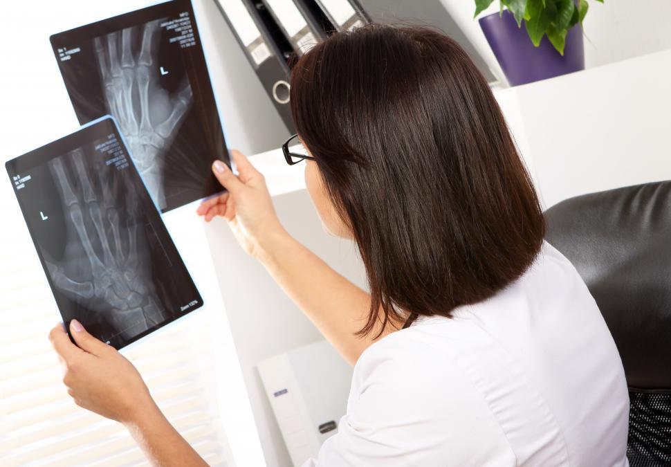 Free Image of Radiologist looking at xray of broken hand 