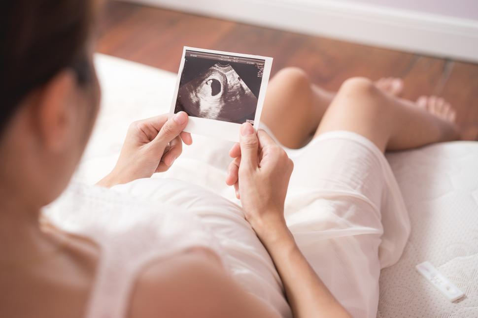 Free Image of Pregnant asian woman looking at ultrasound scan of baby 