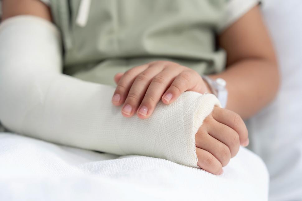 Download Free Stock Photo of Arm in a cast 