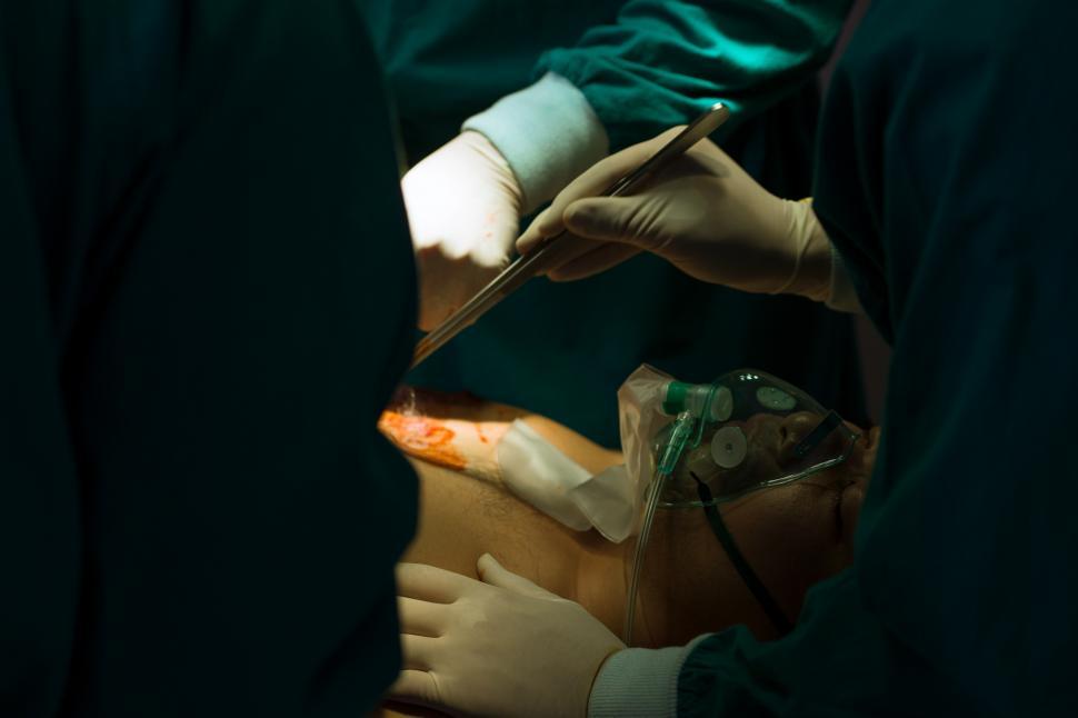 Download Free Stock Photo of Doctors perform surgery 