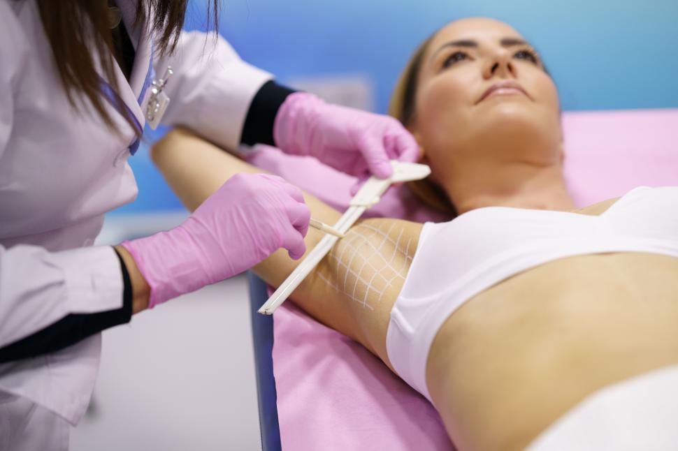 Free Image of Doctor painting on the armpit of her patient, the area to be treated for hyperhidrosis. 