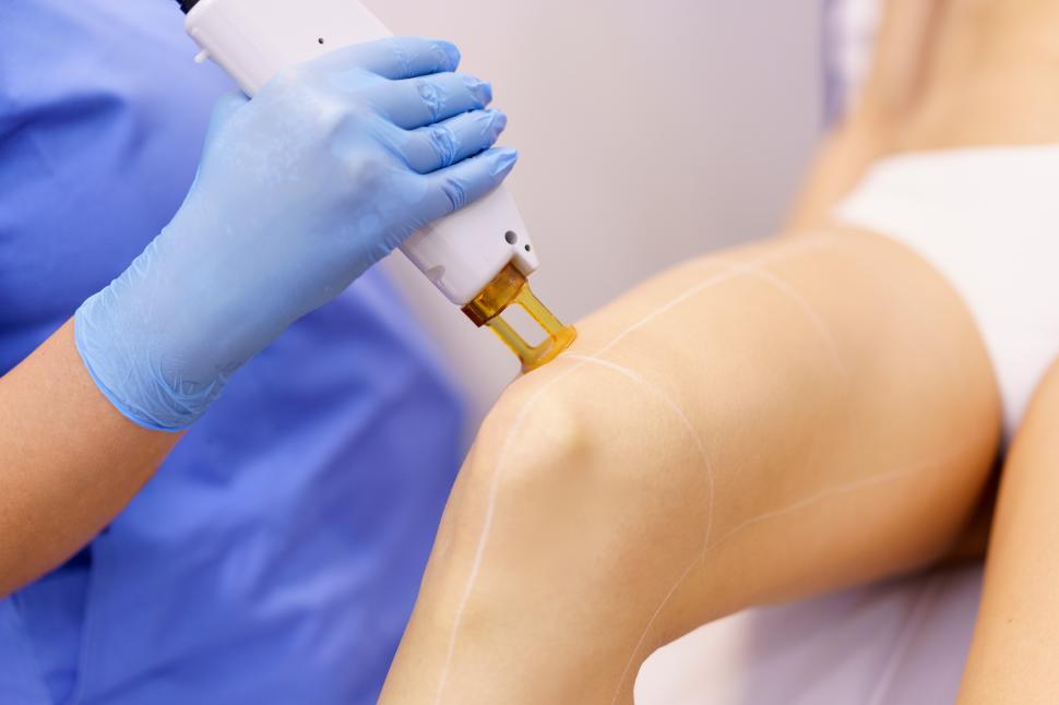 Free Image of Woman receiving legs laser hair removal at a beauty center. 