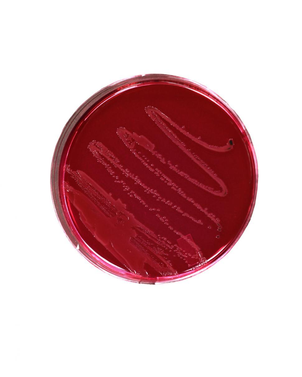 Free Image of Salmonella bacteria 