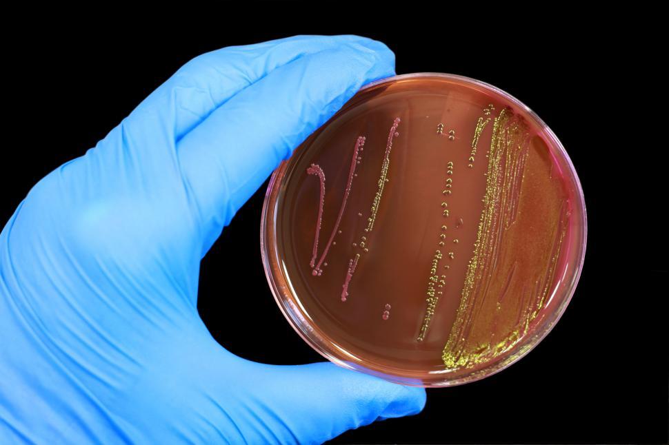 Download Free Stock Photo of Escherichia coli 