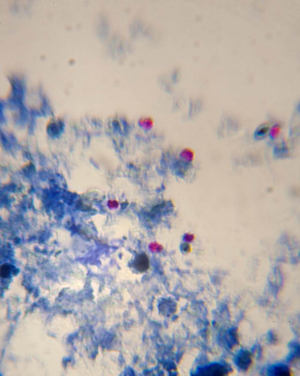 Free Image of Cryptosporidium parvum Protozoa oocysts 