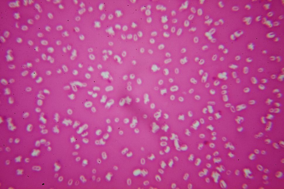 Download Free Stock Photo of Klebsiella pneumoniae capsule stain  