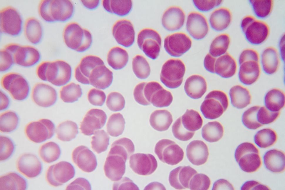Free Image of Red Blood Cells 