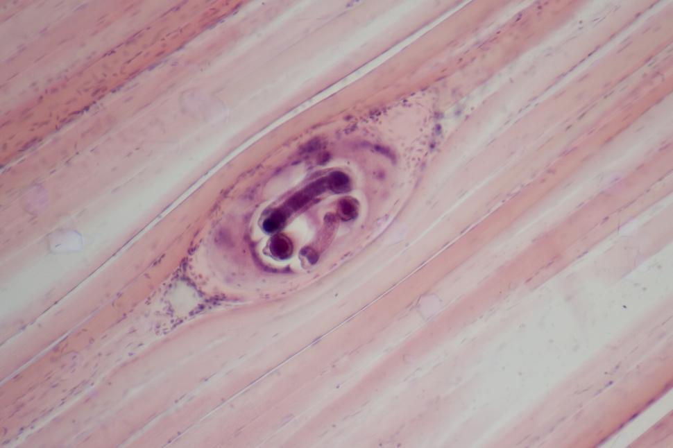 Free Image of Trichinella spiralis 