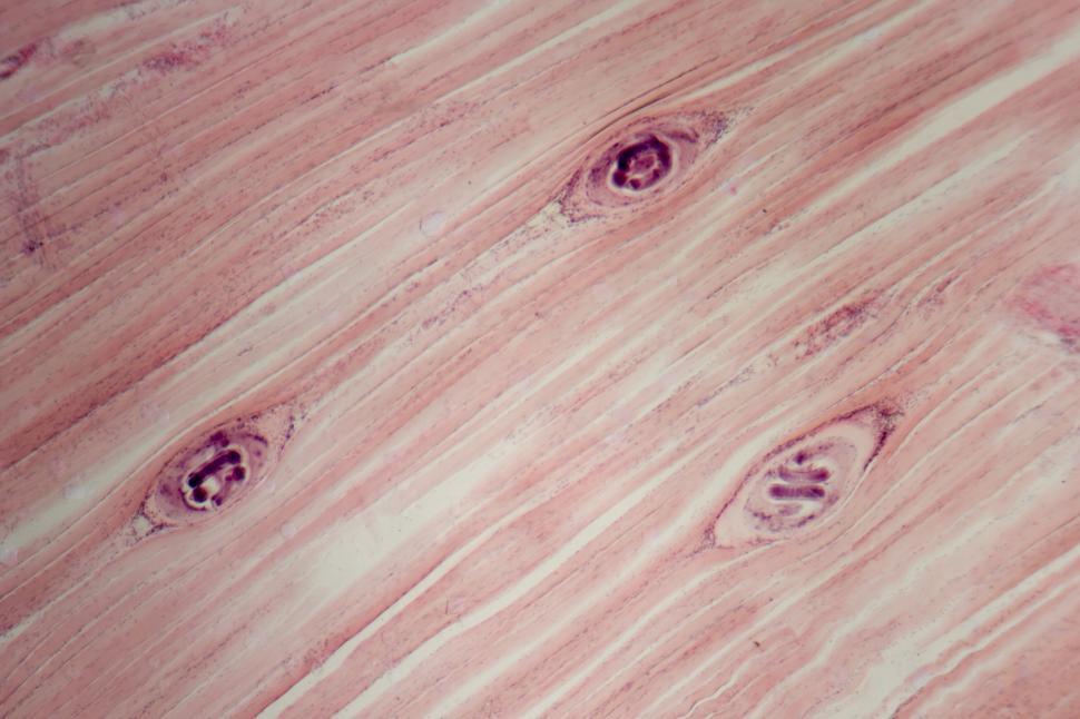Download Free Stock Photo of Trichinella spiralis 