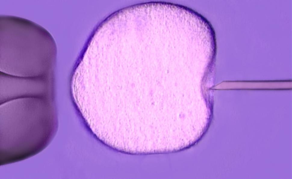 Free Image of IVF - In Vitro Fertilization microscopic close-up 