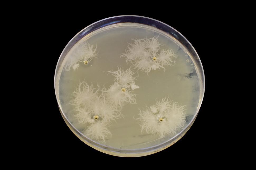 Free Image of Microbiology petri plate 