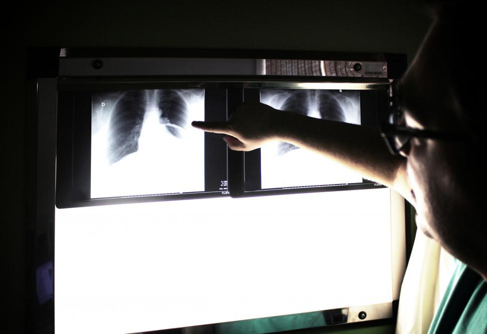 Free Image of Medical doctor pointing to an x-ray image 