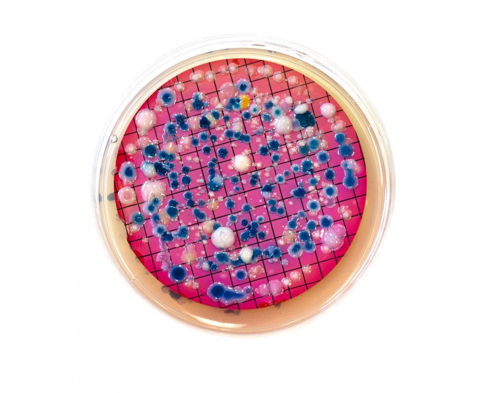 Free Image of Escherichia coli colonies isloated on white 