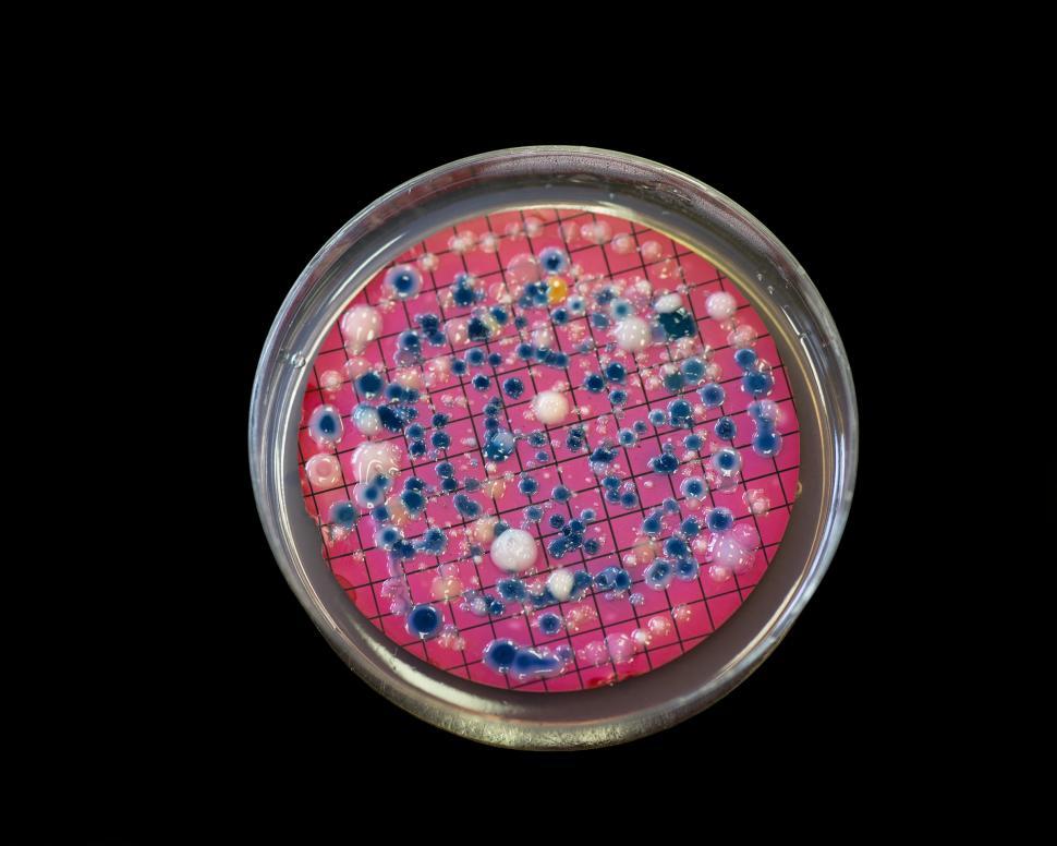 Free Image of Escherichia coli colonies isloated on Black 