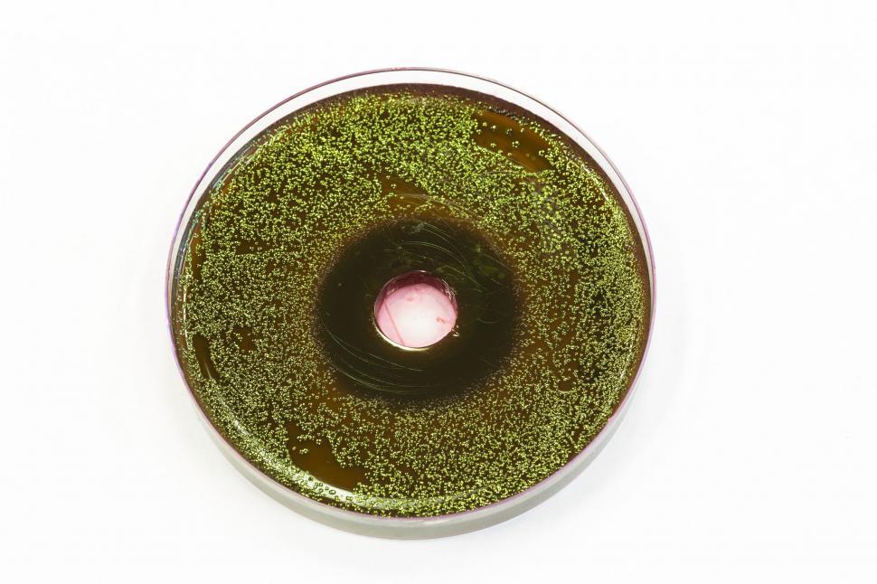 Download Free Stock Photo of Bacteria growing on EMB agar 